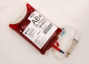 Tại sao AB lại là nhóm máu hiếm?