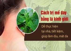 Bài thuốc đông y hỗ trợ điều trị  bệnh nổi mề đay từ rau Kinh giới