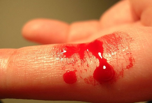 Nhận thấy có sự chảy máu hoặc tiết dịch bất thường